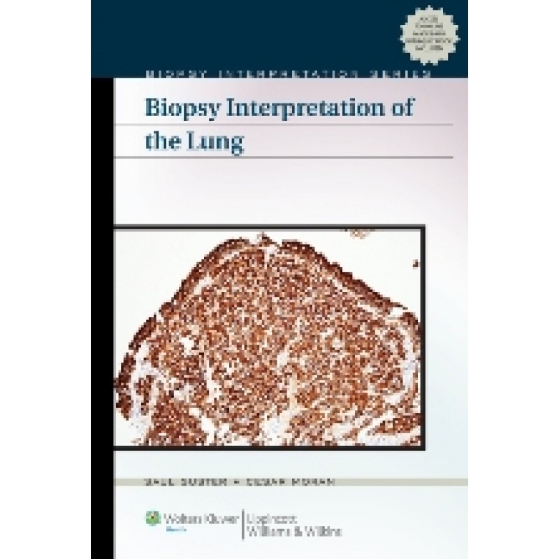 Biopsy Interpretation of The Lung